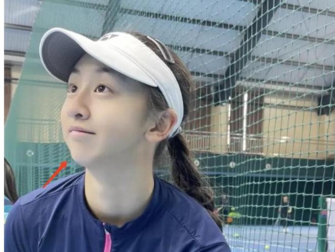 田亮叶一茜为17岁女儿庆生，森碟矫正下巴后青春漂亮