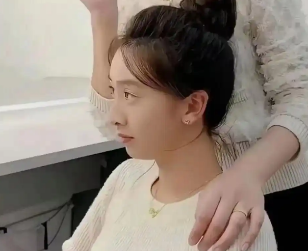 森碟素颜逛街被偶遇，身材高挑气质出众，下巴矫正后颜值大逆袭