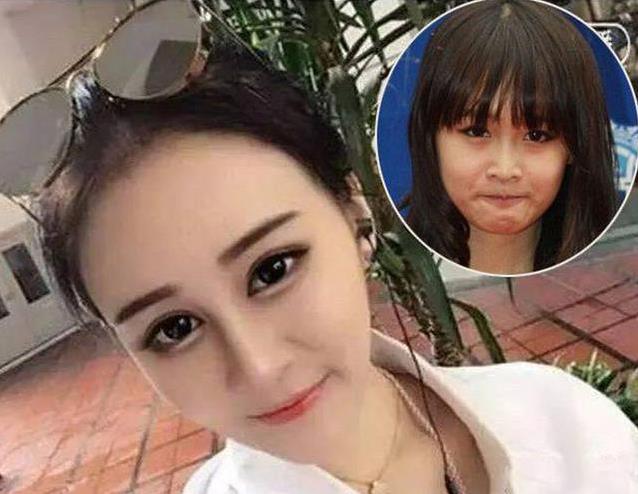赵本山女儿坐拥亿万财富，重度抑郁却让她站都站不稳？
