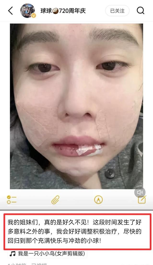 赵本山千金球球患抑郁症，富贵生活挡不住压力，她如何走出阴霾