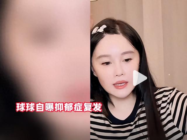 赵本山女儿球球自爆抑郁复发，曾宣布生娃后退网不差直播钱