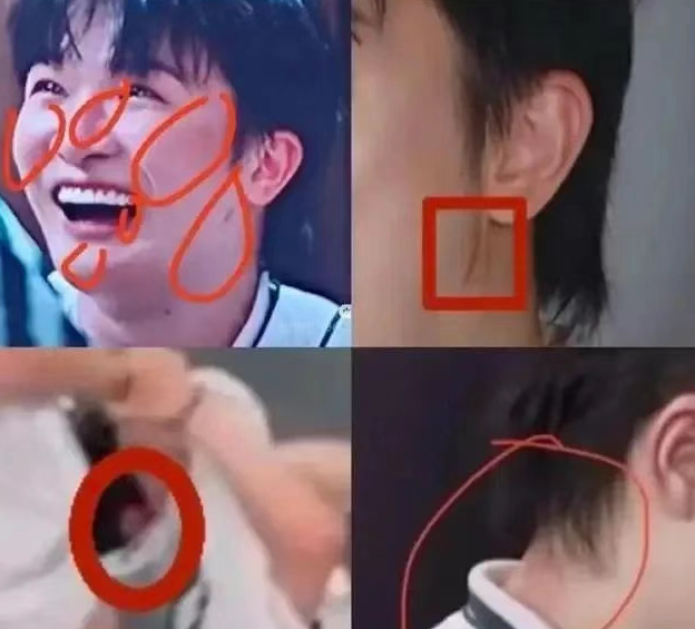 周深录制综艺被嘉宾拖拽11秒，致其颈部勒痕耳朵充血，高以翔事件的教训还不够？