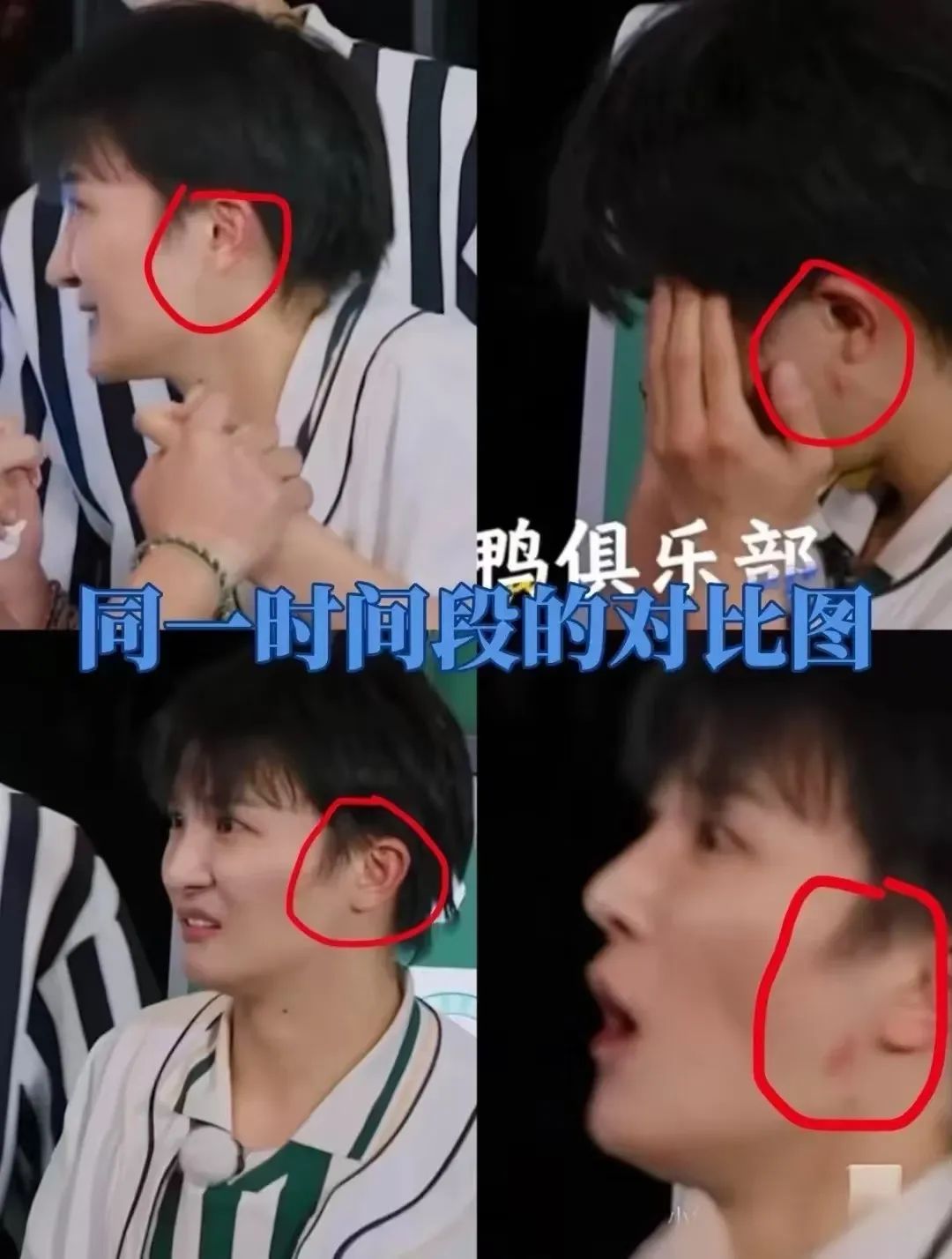 满脸是伤的周深，欠个道歉