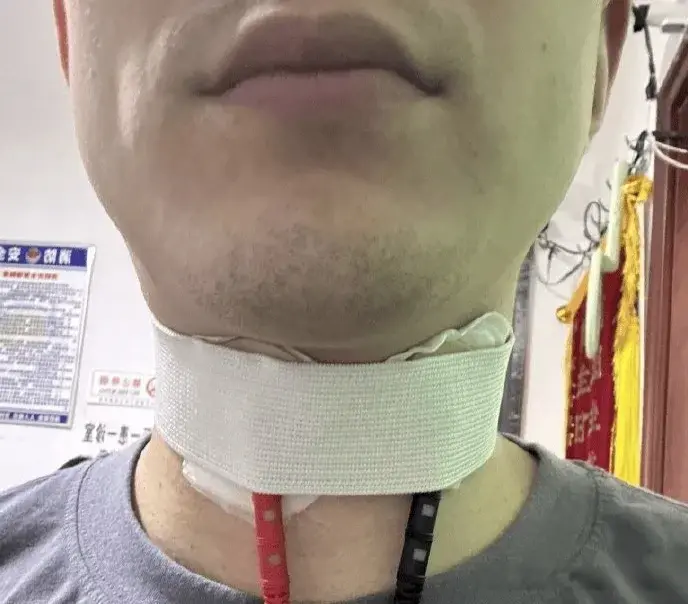 今日CBA消息:遭遇肘击的赵继伟仍在治疗中，杨瀚森已确认回国归队