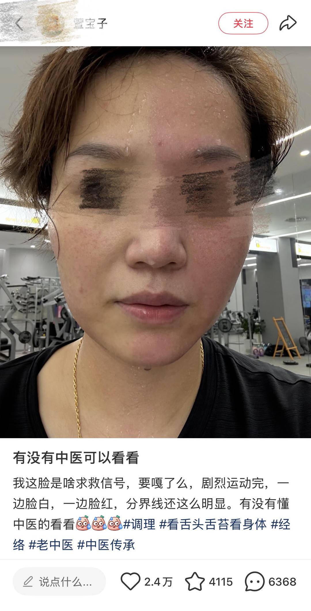 运动后脸一半红一半白？这是什么怪病？医生：可能是神经“打架”