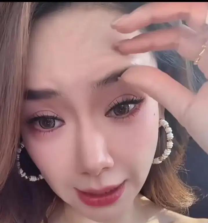 戚薇直播爆料医美翻车，眉毛僵硬压眼睛，她咋还圈粉无数？