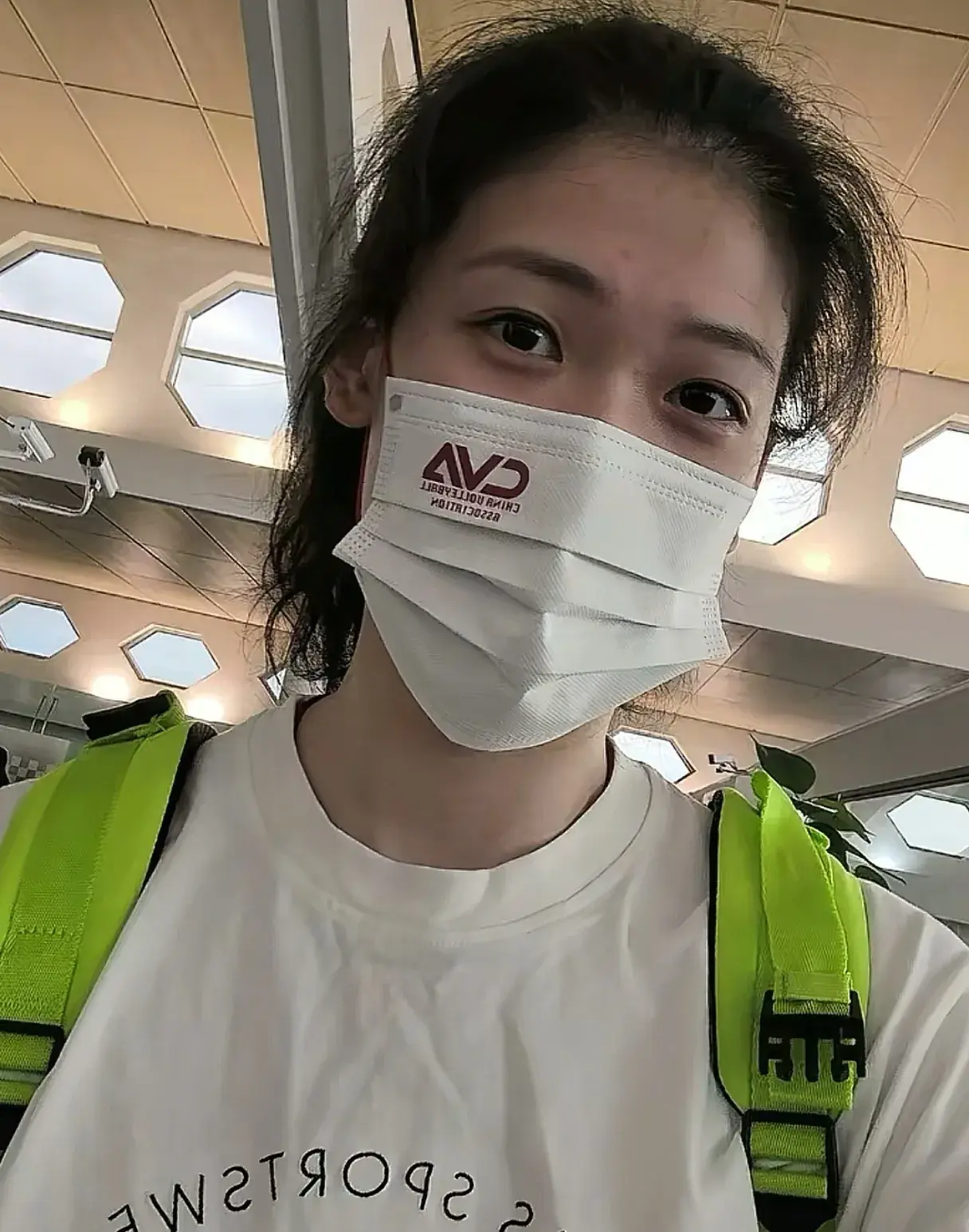 李盈莹发布康复过程！手术照首次公开，白头发抢眼，状态已超预期