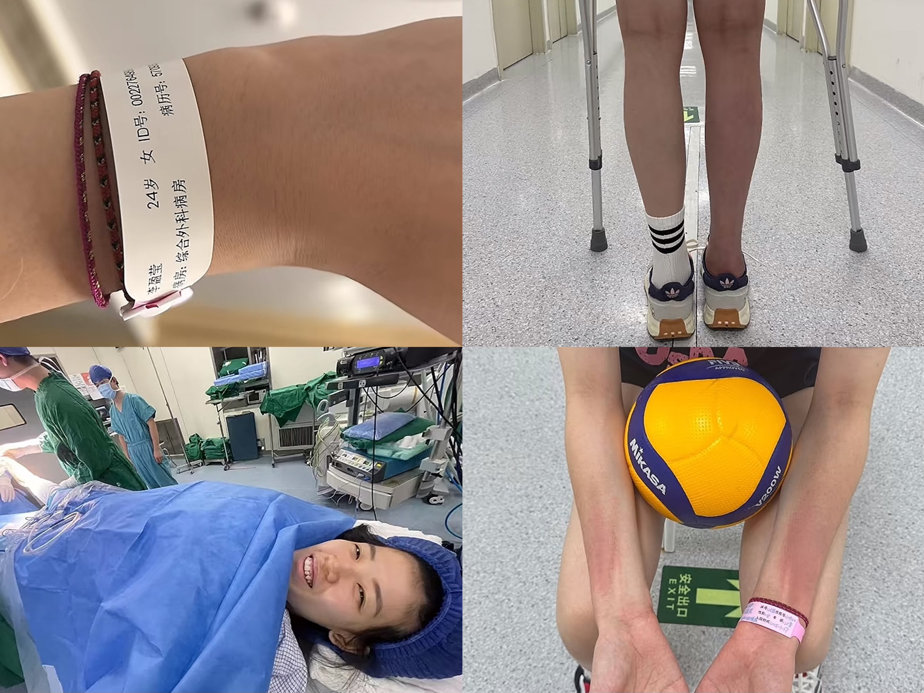 李盈莹公开康复过程 肌肉萎缩 手术留疤 中国女排强力主攻复出