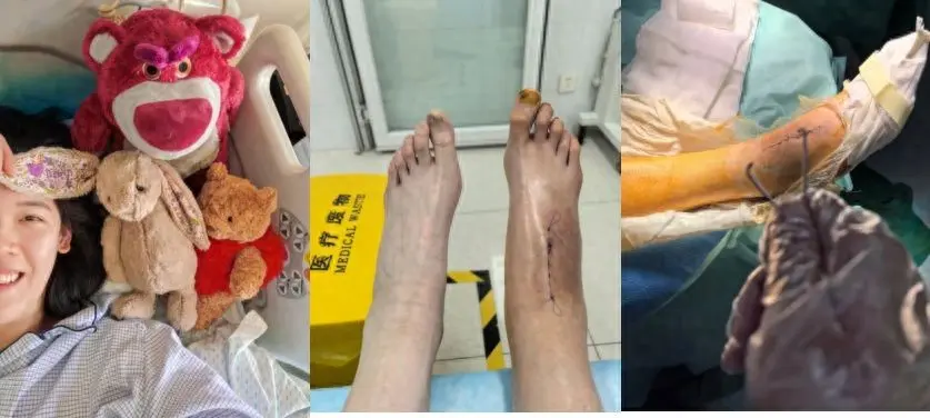 国际排联发文关注！李盈莹公开康复细节，吴梦洁未登场令人担忧