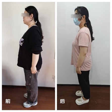 上海一医院举办减重大赛，冠军选手60天减重约30斤