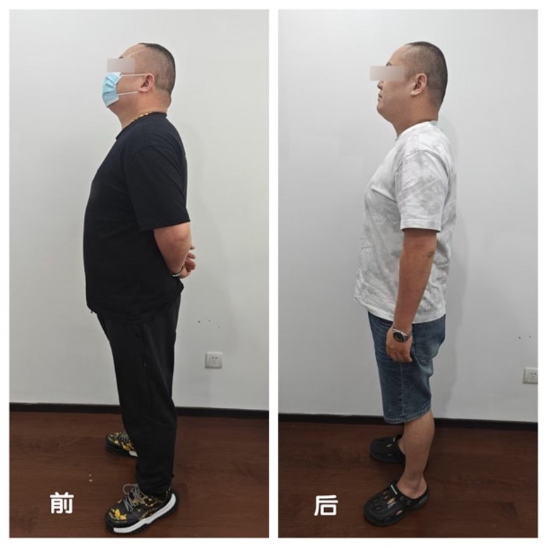 上海一医院举办减重大赛，冠军选手60天减重约30斤