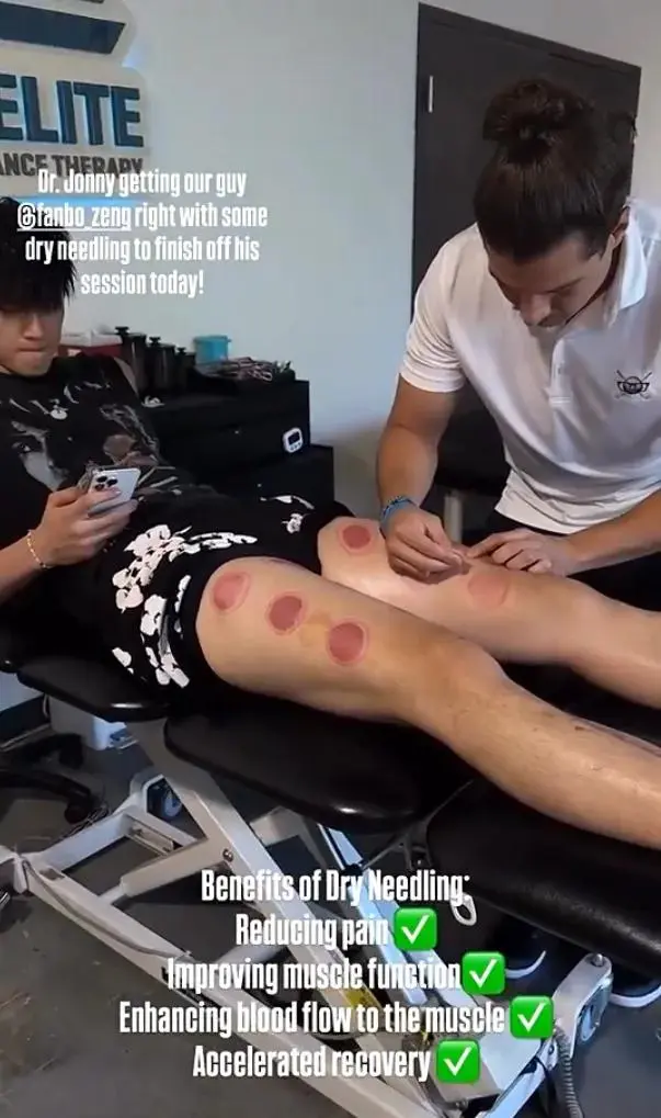 媒体人：曾凡博目标是篮网双向合同 现阶段主要是看他的恢复情况