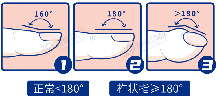 а˫֪ѣϳ5仯Сǰ֢źţ