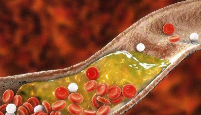 “高胆固醇”食物榜单公布：鸡蛋排最后，第1名有些人还当成补品