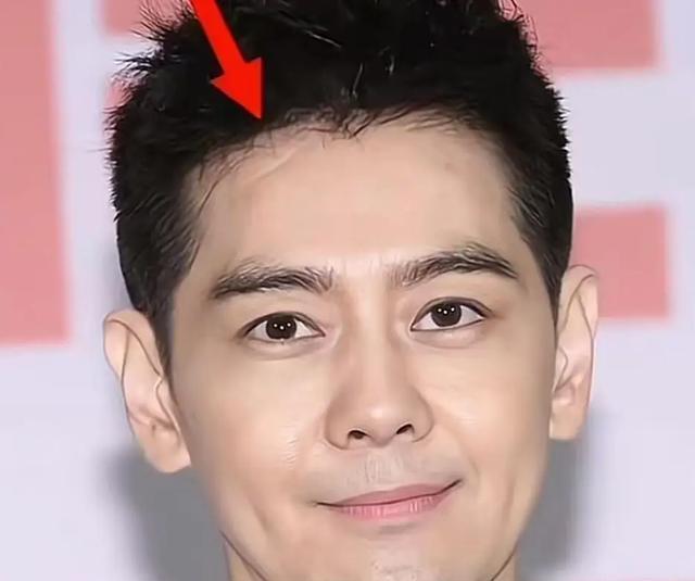 林志颖：如今再没有“不老男神”的称号了，车祸的杀伤力太大