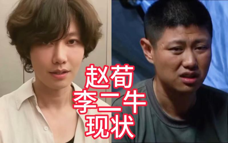 41岁赵荀现状：骨盆用3颗钉子挂在腰上，“特种兵爆改成美娇娘”