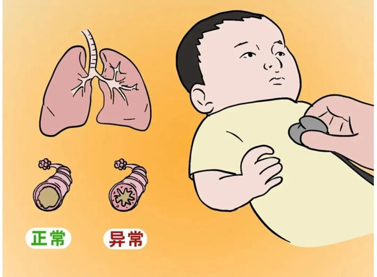 症状类似感冒！早预防，早识别！
