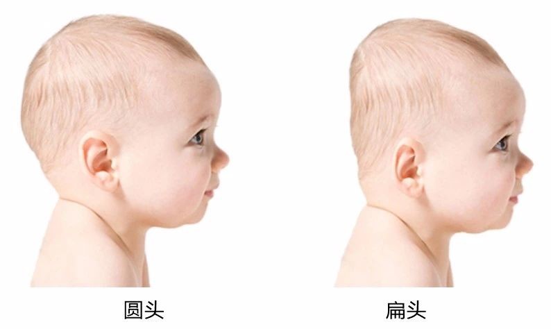 为啥老人非得给娃“睡扁头”？圆扁头差距不止颜值