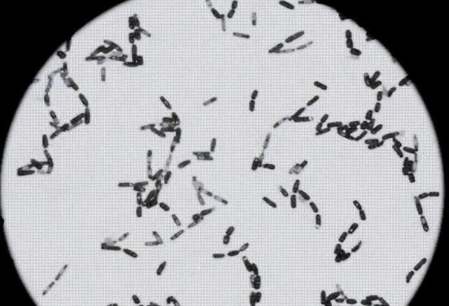 一定要戴手套！29岁男子10天离世，死亡率近100%：你我都在犯