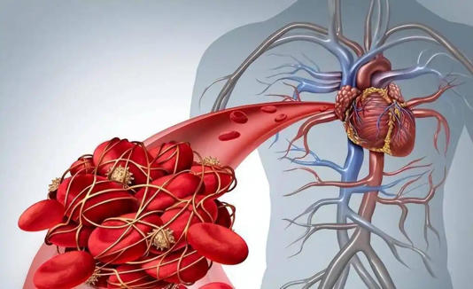 血管“清洁工”被找到！不是木耳，55岁后常吃血管变干净