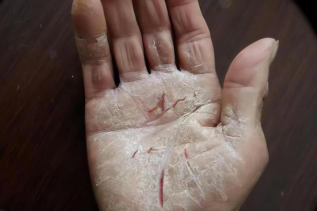 人到70岁多看手，长不长寿能显现？提醒：手上有这些表现值得恭喜