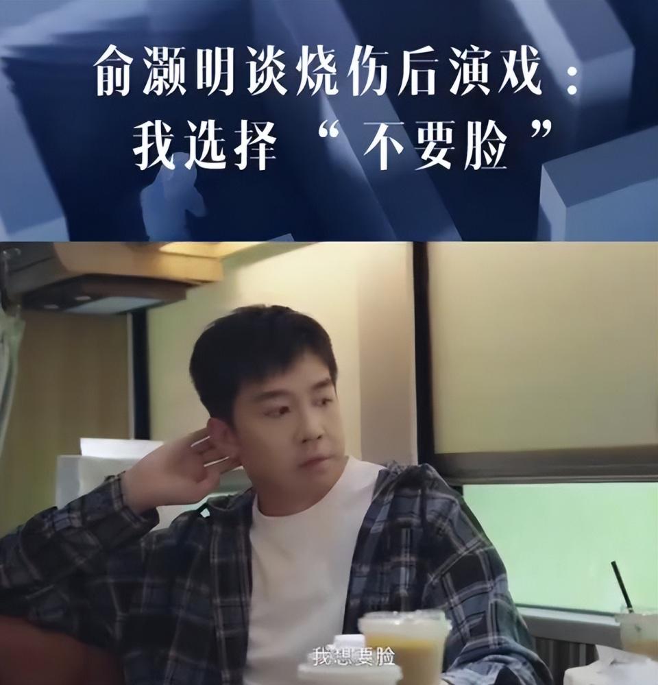 俞灏明自曝曾因脸伤毁容后遭剧组拒绝，既然不能“靠脸吃饭”，那就不要脸了