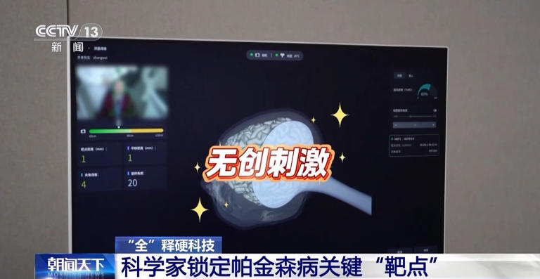 科学家锁定帕金森病关键“靶点” 实现无创精准治疗