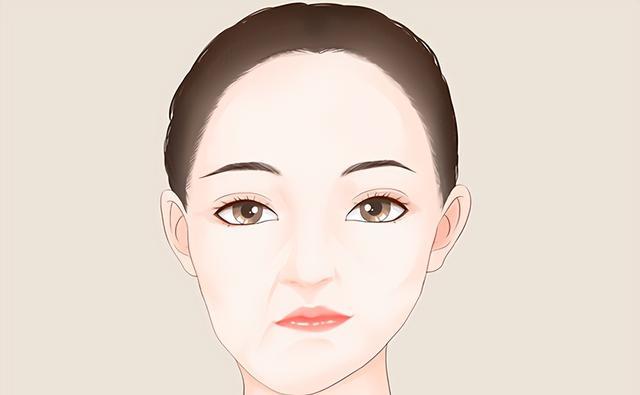 中国脑梗越来越多，美国却在减少？除了补充叶酸，这3件事也要做