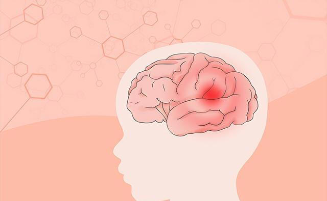 中国脑梗越来越多，美国却在减少？除了补充叶酸，这3件事也要做