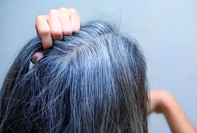 医生发现，凡是白发早生的人，大多都有 2 个共性，日常不妨多观察