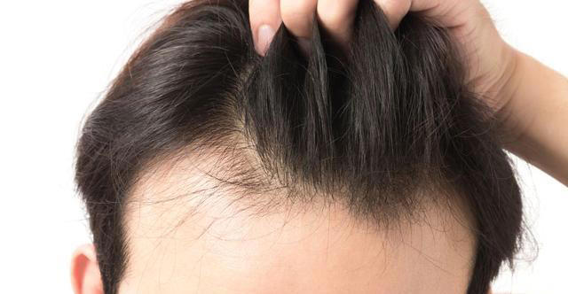 医生发现，凡是白发早生的人，大多都有 2 个共性，日常不妨多观察