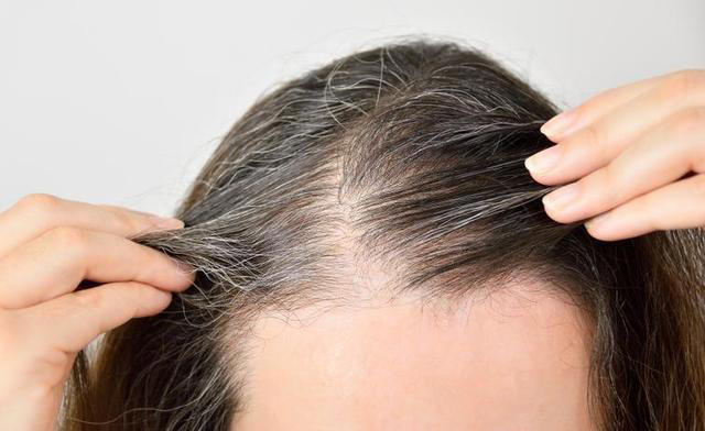 医生发现，凡是白发早生的人，大多都有 2 个共性，日常不妨多观察