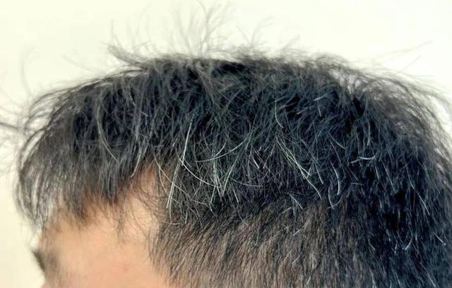 医生发现，凡是白发早生的人，大多都有 2 个共性，日常不妨多观察