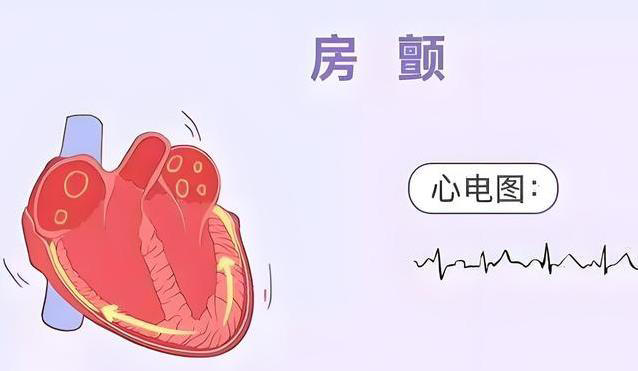 脑梗来袭前，手脚麻并非最可怕信号，4种隐蔽表现才是致命预警