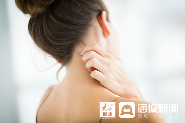 什么是光敏性皮炎 该如何预防? 一文了解