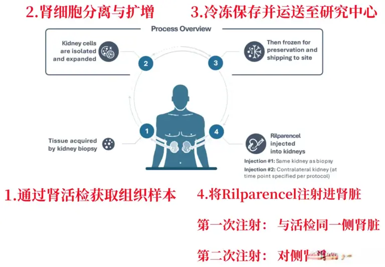 肾病研究新进展!CJASN：培育自体肾细胞“重返”肾脏