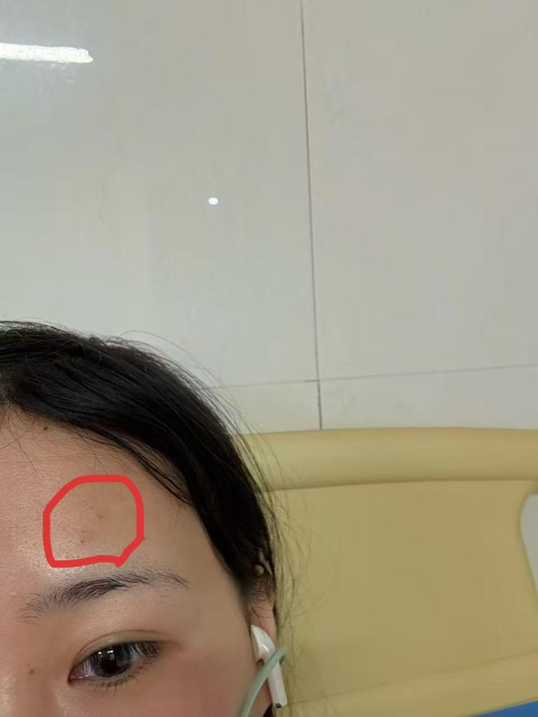取亚硒酸“中毒”之后：一个劳动者的职业病鉴定死胡同