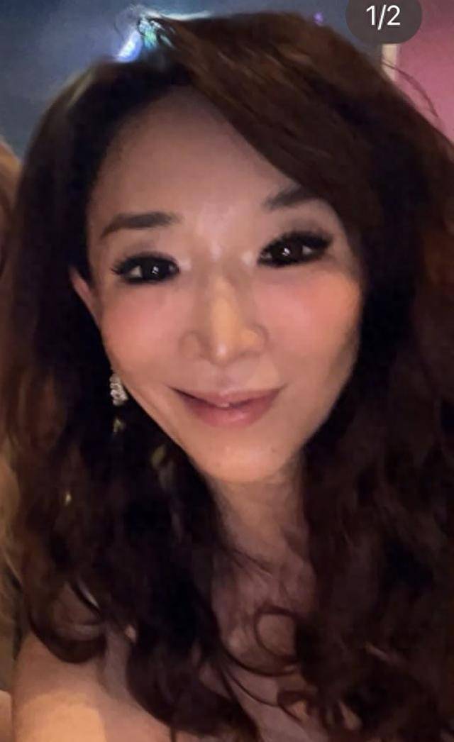 李嘉欣和闺蜜提前庆祝母亲节，一旁闺蜜脸型怪异，医美后遗症严重