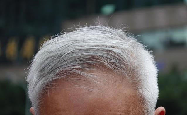 白发多的人更长寿? 研究追踪大量老人，没想到真相竟是这样