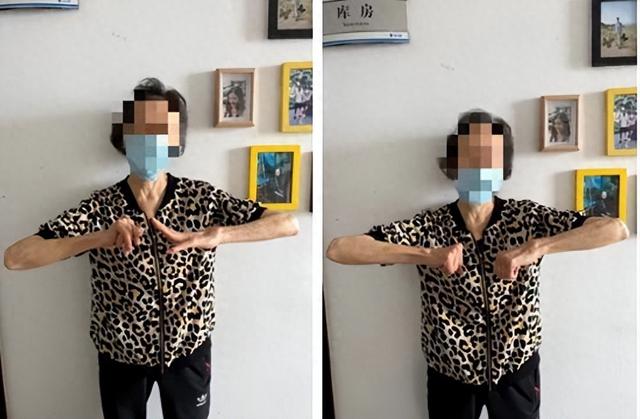 “焊死”20年的手腕重新转动了! 3D打印“量身定制”假体让类风湿患者重获新生